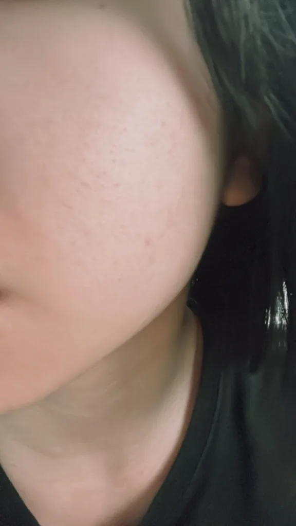 霓淨思-超爆水透亮煥白面膜敷後